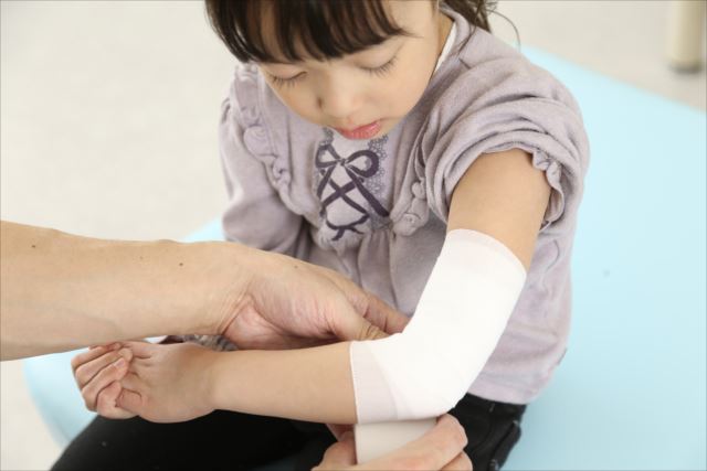 腕を骨折中の子供の患者様